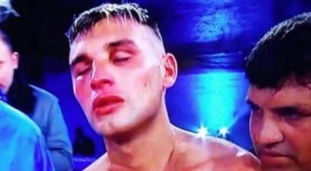 俄罗斯拳手达达舍夫被重炮手马蒂亚斯打死 拳王被对手活生生打死!