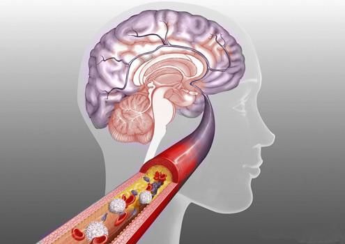 纸短情长 八旬老人脑出血意识昏迷 老伴病床前呼其名字