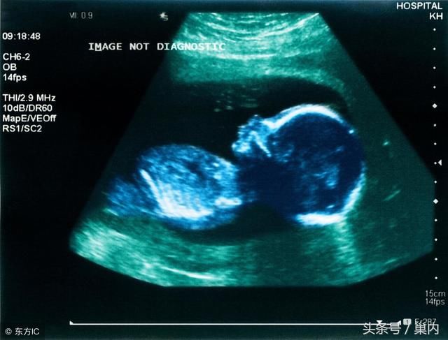 怀孕多久能做b超看出孕囊 t0167320d63813b424e.jpg