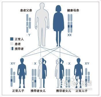 鸡皮肤怎么办?鸡皮肤是什么原因引起的