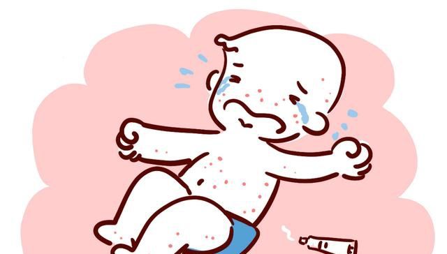 宝宝又起痱子了?3种假的“除痱神器”不靠谱,反而容易伤到宝宝 澳门凯旋门游戏平台
