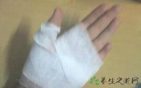 烫伤为什么要用弹力绷带
