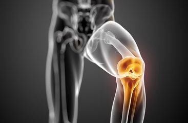 膝关节关节炎有哪些常用的检查方法?学会了你也可以诊断膝关节炎