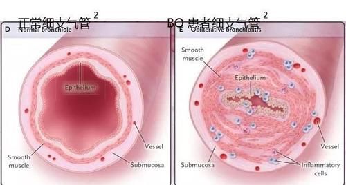 武汉出现新肺炎病毒