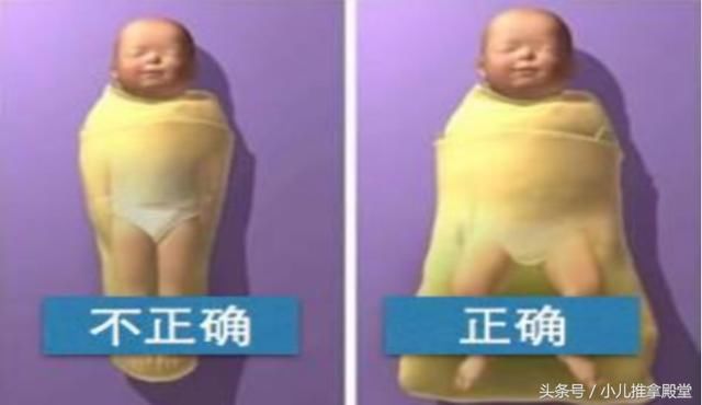 不要看到宝宝八字腿就认为不正常,如果还在纠