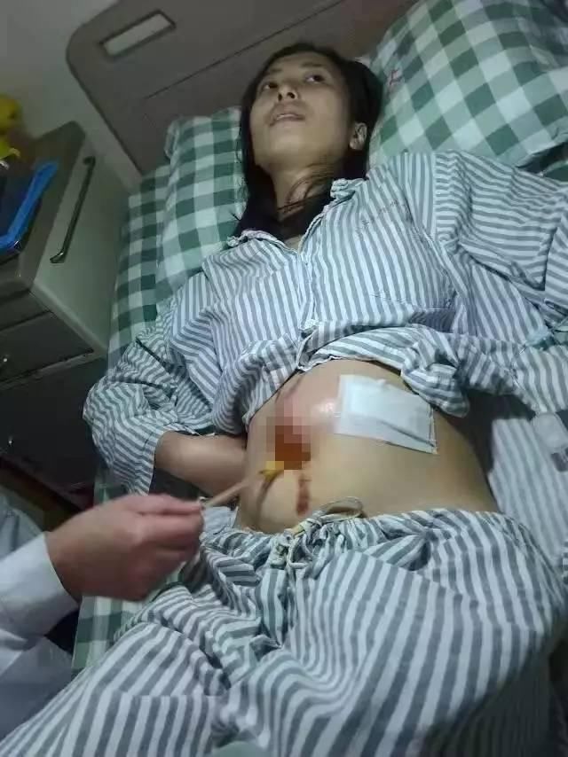 22岁女生腹大如球，救护车刚到现场，医生却说不用抢救了