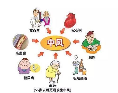 脑梗死分四种类型,一种比一种致命!