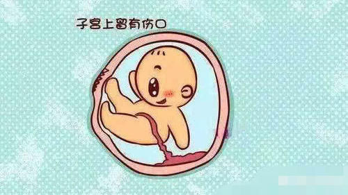 一胎是剖腹产,二胎要多少周的时候生?经历过的