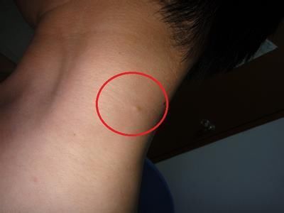 皮肤5种变化是病变信号