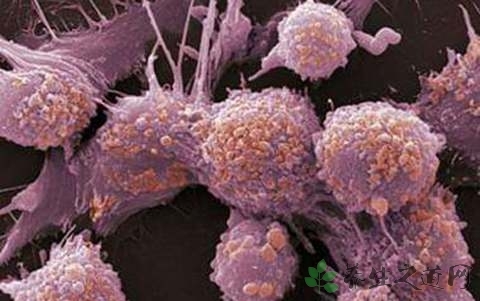 肿瘤指标偏高什么意思