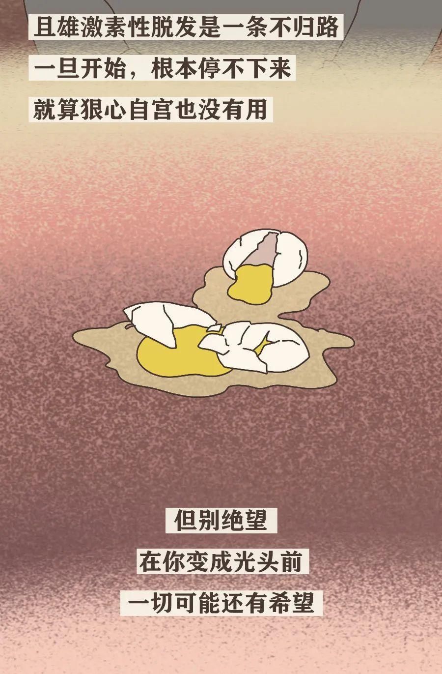真男人，都容易秃