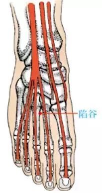 失眠多梦、睡不踏实？你其实睡了个假觉！教你几招，一觉到天亮