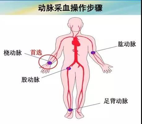 在这个流感肆虐的冬季，一位呼吸重症科医生的思考