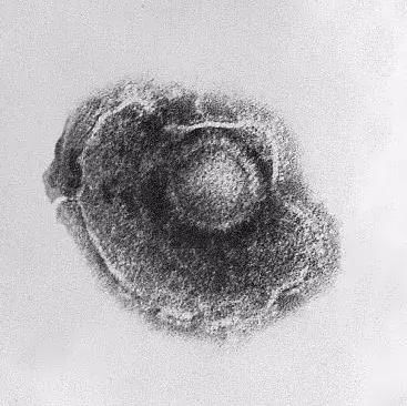 水痘痊愈就能终生免疫？其实病毒仍潜伏在神经