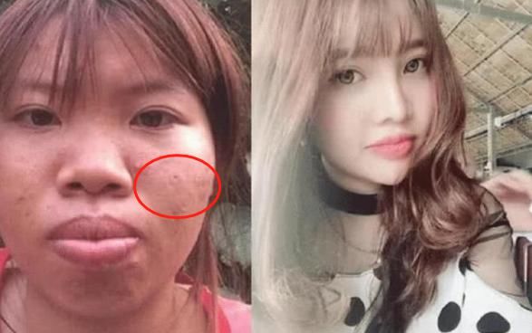 越南美女因太丑被男友抛弃，整容成美女后被富豪狂追，如今怎样？