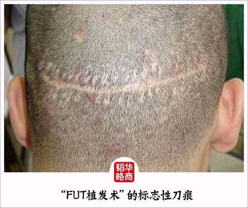 中国男人的“头等大事”，如何催生为千亿规模的超级生意？