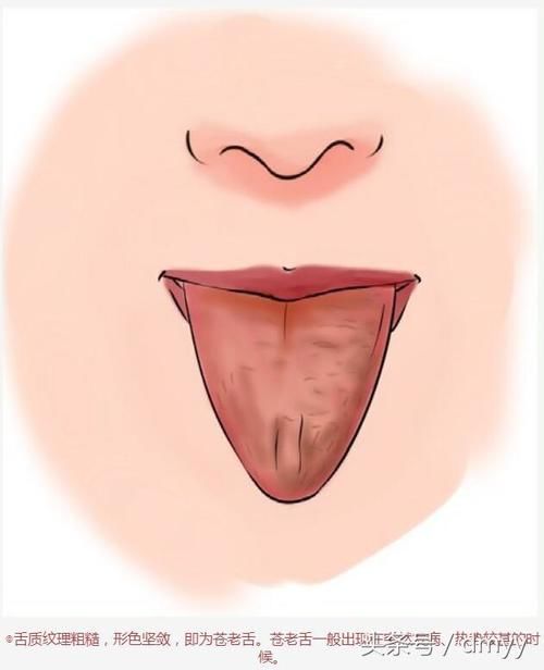 舌头泄露的身体秘密,看看中医舌诊