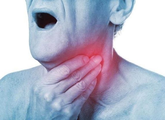 慢性咽炎早期的3个症状,别错过最佳治疗时间!
