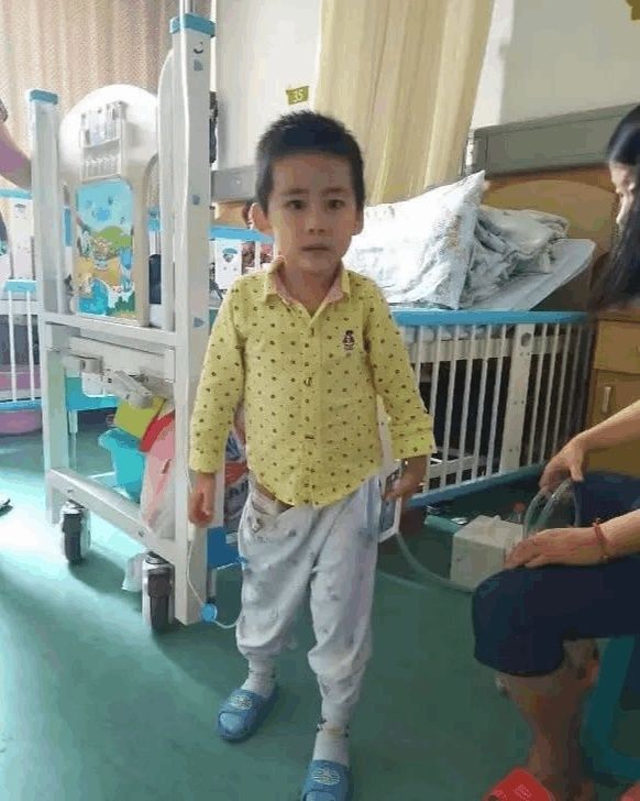 4岁白血病宝宝经历上百次骨刺手术: 救救我吧
