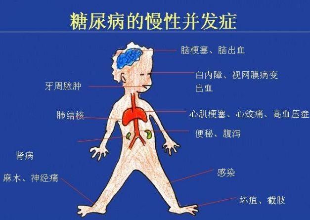 给高血糖者的10条医嘱，每句话都能降糖能救命，请存好!