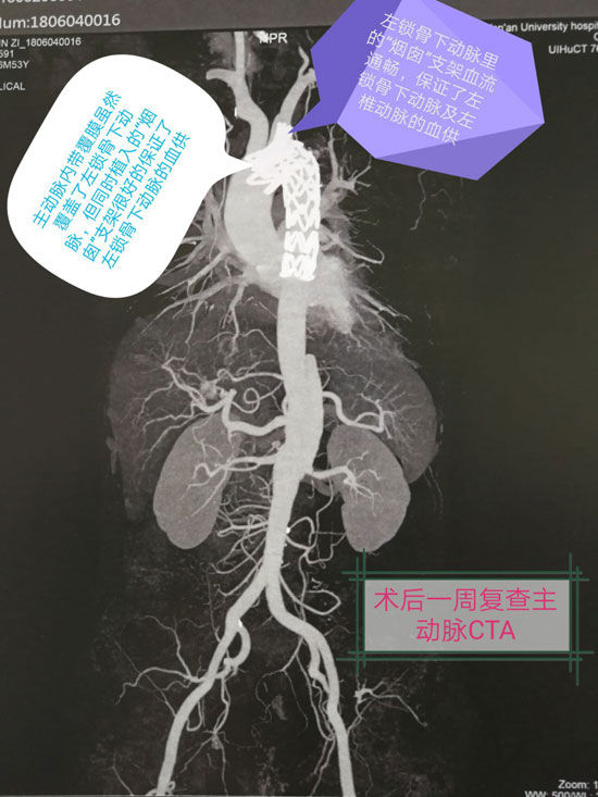 t0190dcbebf7f1300e6.jpg