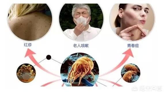 除螨虫最快方法是什么?