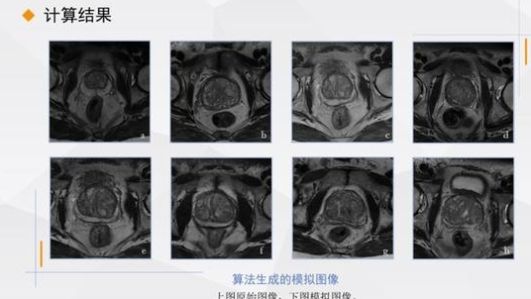 编程学有没有用