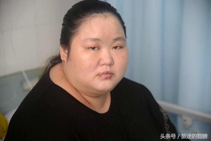 母爱的伟大!直击270斤产妇生男婴,产后体重降