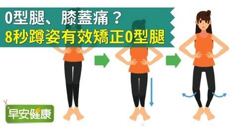 O型腿、膝盖痛?8秒蹲姿有效矫正O型腿
