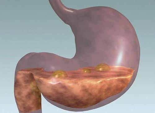 胃不好会口臭?早起常用开水泡它喝,坚持1个月