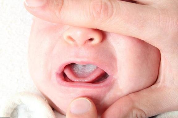 如何判断宝宝是否积食? 宝宝积食怎么预防