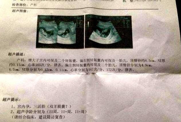 产妇怀孕三个月去医院检查,产检结果出来后,老