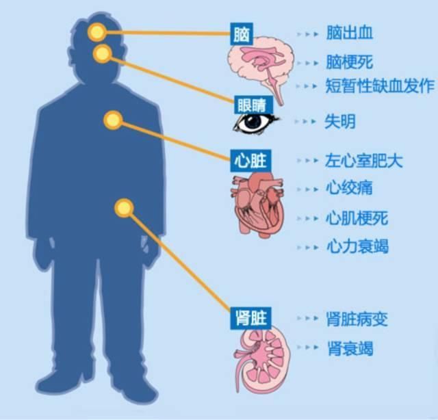 为什么一些高血压会那么“顽固” 呢?