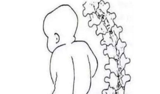 「孕婴知识」宝宝过早站立到底有哪些危害,宝