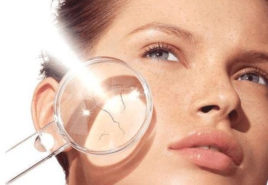 教你如何辨别脸上色斑小常识,六种不同类型的