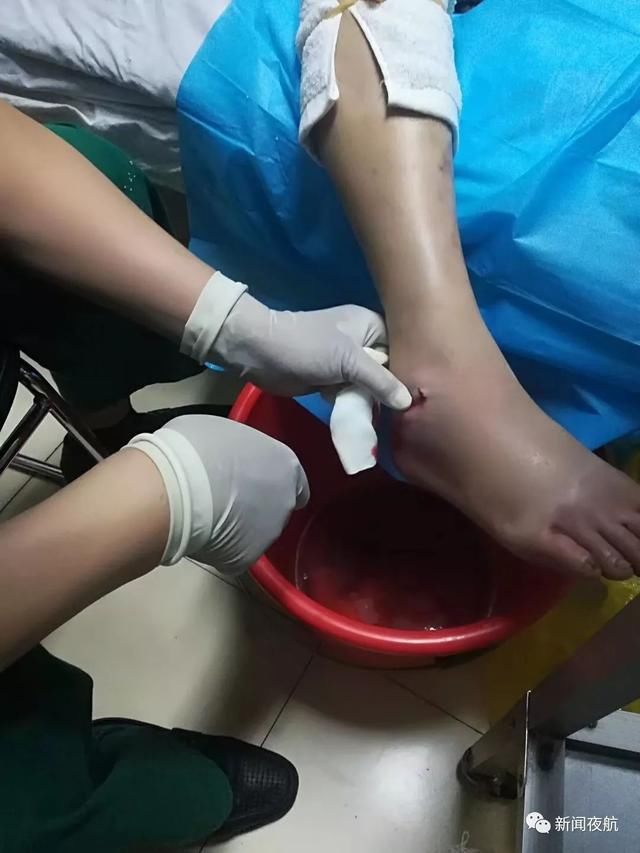 有毒!男子上山挖野菜被“土球子”袭击,紧急救治!医生说:切不