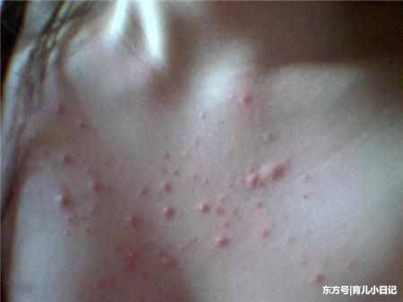 女人身体湿气重,这一处部位就越大!看看怎么