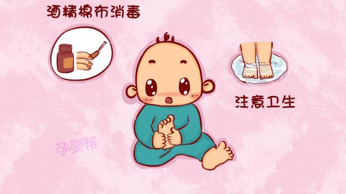 宝宝感染灰指甲的2大初期症状,90%的家长都会