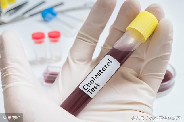 血脂过高怎么办？推荐4种食物，把血脂“吃”掉