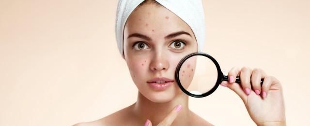 怎样除掉面部螨虫,教你除螨虫最好的方法