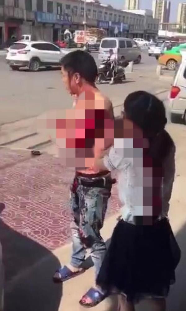 津云快讯西安发生持刀砍人事件 8人受伤伤情较