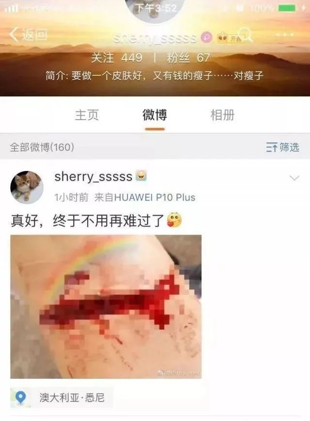 毫无人性，中国女留学生微博直播割腕，评论却都是让她去死