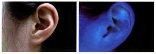 吸猫人士注意,如何辨别喵星人得猫藓,用这个办