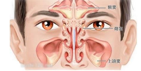 医学这么发达,为什么鼻炎还是那么难治好?