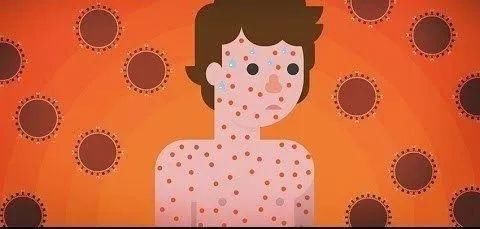 最新最靠谱的美国留学疫苗全攻略