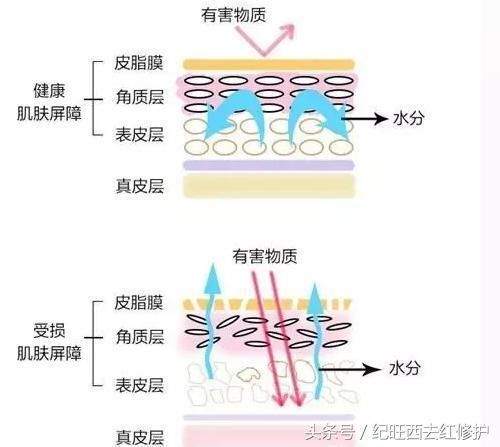 激素脸都有什么症状?激素对皮肤造成的这些危