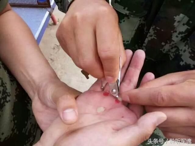 当兵都知道有个科目不仅危险,还扯掉手上的老