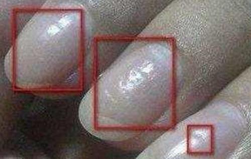 身体出现这3种现象,小心是癌症的信号,赶紧去