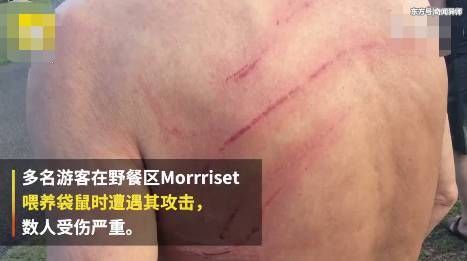 澳大利亚多名游客遭袋鼠攻击 胃部被撕裂 脸部缝了17针！