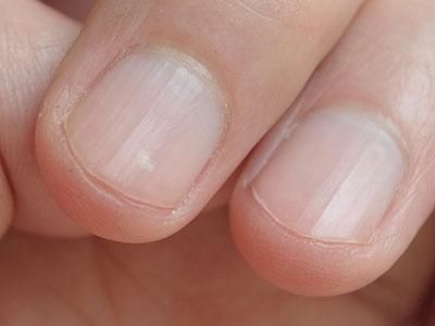 肝脏好不好,这七个表现让你提前知道,远离肝癌